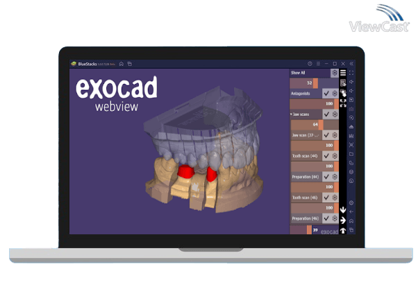 Download exocad webview - Free STL OBJ and 3D Model Viewer for PC ...